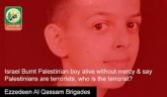 al-Qassam: burnt palestinian boy alive and Palestinians are terrorists?