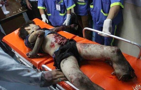 Gaza - another boy victim of DIME weapon from Jewish military