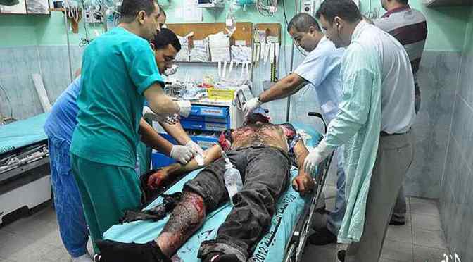 Gaza- hospital, man burned by Jewish military strike