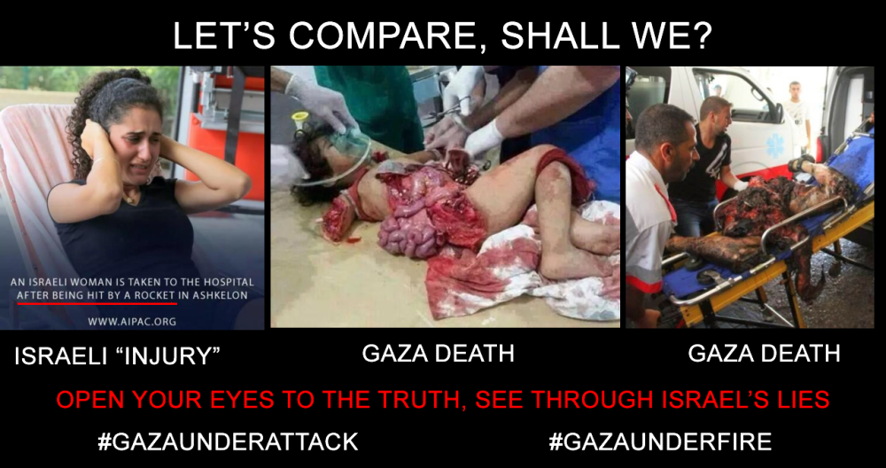 Let's compare: Israeli "injury"  and Gaza death