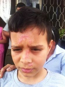 Palestinian boy attacked by violent Jewish settler colonists escaped kidnapping attempt. ISM